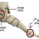 발이야기 이미지