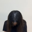 선화정헤어센스 | 용인가르마교정, 용인두피문신 - 닷센스 용인광교 3회시술후기