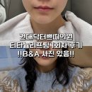 밀크피부과의원 | [피부과 추천] 건대닥터쁘띠의원 티타늄리프팅 1회차 솔직후기❤️