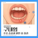 고덕스타약국 | 비타민 B 영양제 추천｜구내염 주요 증상과 원인 총정리