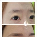 수가인 이미지