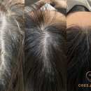 크레센트421 이미지