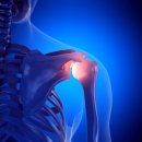 삼성센텀정형외과의원 이미지