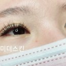 김미더스킨