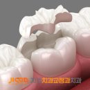 퍼즐치과기공소 이미지