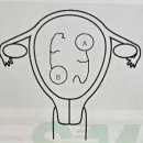 [20주 4일]쌍둥이 중기 정밀초음파(feat.태아보험) / 삼성서울병원