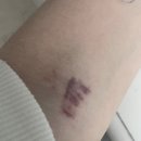 이지현내과의원 | [병상일지] 아랫배 통증 증상 그냥 두면 안됐다..