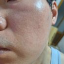 남1통 | 마몽드 포어 슈링크 바쿠치올 크림 1통 사용한 후기, 모공 변화가 있을까?