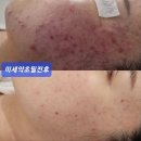 예담에스테틱 네이버블로그