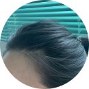 (주)메디쿼터스 | [10월] 아무도 안궁금 하겠지만 저녁 샴푸러의 지성 두피 관리기