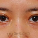 쌍수인