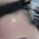 스칼프디자인센터 홍대점 이미지