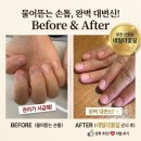 관심길-4 | 부천 네일더꽃길 상동아크릴연장 물어뜯는 손톱 관리받은 후기 이게 같은 손톱이라고? 전후 공개