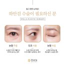 목동/오목교/영등포 성형외과 스텔라의원 고객님의 리얼 후기👍