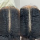 이엔뷰티 | 군산 두피케어는 ‘이엔뷰티’, 모리바이브 후기