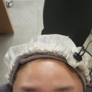 해마사 | 하남 두피관리 웰킨두피탈모센터 마사점 올킬스케일링 후기