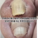 풋풋한리쌤 성수본점 | 군자동 파고들고 말려드는 내성발톱 전문점은 정직한 케어를 하는 풋풋한리쌤입니다