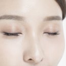 위드유원일성형외과의원 이미지