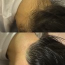 안산왁싱 시스터왁싱 깔끔한 뒷목 왁싱으로 길어 보이는 목