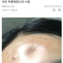 딱밤 이미지
