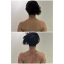 대구 중구 동성로 피부관리 등관리는 무조건 김지민약손테라피 솔직후기
