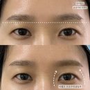 벨르엔브로우