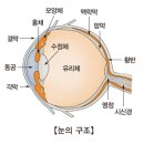 비문증 이미지