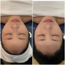 홈플러스익스프레스김해삼계점 | 김해 삼계 피부관리 빈스뷰티｜ 1:1 대표원장 맞춤케어로 달라진 피부