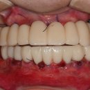 누가치과기공소 이미지