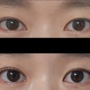 블링 | 춘천 속눈썹펌 맛집 후평동 &#39;블링아이&#39; 방문후기 🖤