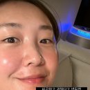 보라인셀덤 이미지