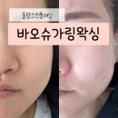 상봉길 | 환절기 칙칙한 피부 탈출기✨ 바오슈가링왁싱에서 물광스킨플래닝으로 되찾은 찐광 피부결 (feat. 헤어...