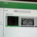에버엠치과의원 네이버블로그