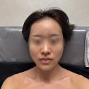 김포피부관리 장기동피부관리 벨리사뷰티 리프팅 자세한 후기