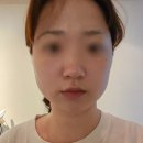 노원구 피부관리 &#39;미스킨케어&#39; 파워트리 윤곽관리 솔직후기