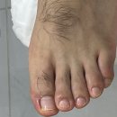 엘제이뷰티(LJ Beauty) | 청주오창점레푸스|무좀내성발톱스케일링의체계적관리방법