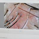 대흥빌딩 | 대전 탈모 두피관리 숲칼프 대흥점 방문 후기