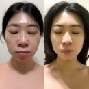 해궁아구찜 | 하단 피부관리 남포동 에스테틱 맛집 물광피부 만들기, 여기선 식은죽먹기! 「에스테틱 힐링수」