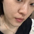 크리스탈로74번길 | 청라에스테틱 [다미에스테틱],늘어난 모공 관리 받고 왔습니다