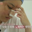 렛미인피부 이미지