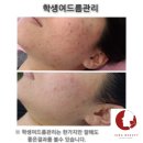 정피부 이미지
