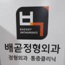 장편한외과의원 | 발목 접질려서 반깁스한 사연은?? 배곧정형외과 후기에요