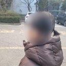 탈모 치료보다 희귀병 환아 지원이 먼저 아닌가요. 이미지