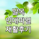 번화1로R | 엠아이병원(발목 인대파열 재활 후기입니다.)
