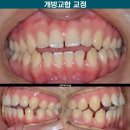 연세하랑치과의원 이미지