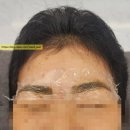 렉슬약국 | (내돈내산)강남 쥐젖/사마귀 제거의 끝판왕, &#39;이로아뷰티&#39;(눈썹만들기까지-!)