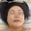 안산 고잔동 피부관리 리뉴에 60대 홍조 &amp; 속건조 케어 솔직 후기