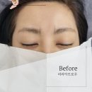 리리아브로우&스칼프 이미지