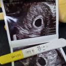 에덴산부인과의원 | [임신 5주차] 산부인과 선택 기준 5가지 ㅣ 담당의 선택 기준 ㅣ 수원리베르여성병원ㅣ임신확인서 발급