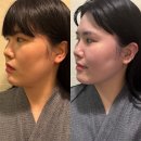 부산 에스테틱 커넥트 현대 부산 세라피스파 안면유지인대 수기관리